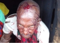 Elderly Maasai man wounded in the military attack on protesters. © Survival