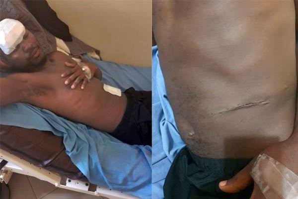 Muhammad Kabanda, a vendor in Owino market has accused Old Kampala Hospital of harvesting his kidney without his consent.
