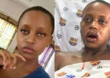Lowenah Nankya, a senior six student of Lugazi Mixed School was in 2020 hit by a rubber bullet when she was together with her mother caught up in the melee as KCCA forced vendors off the street