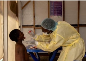 A laboratory nurse, takes a sample from a child declared a suspected case of Mpox in Munigi, DRC. Photo/Reuters