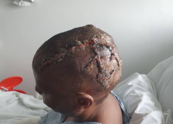 Court in Kampala viewed crime scene videos in the Henry Katanga murder trial. Footage showed a nurse describing Molly Katanga's severe head wound and other injuries.